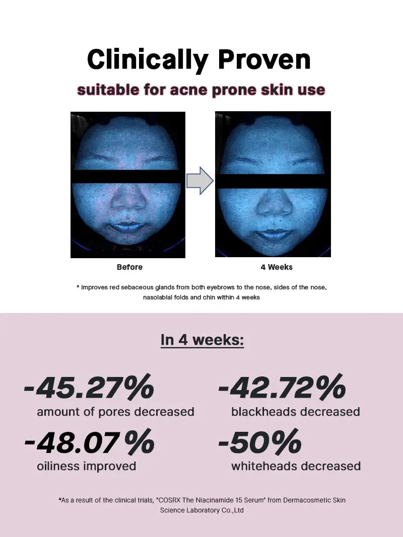 COSRX The Niacinamide 15 Serum Acne
